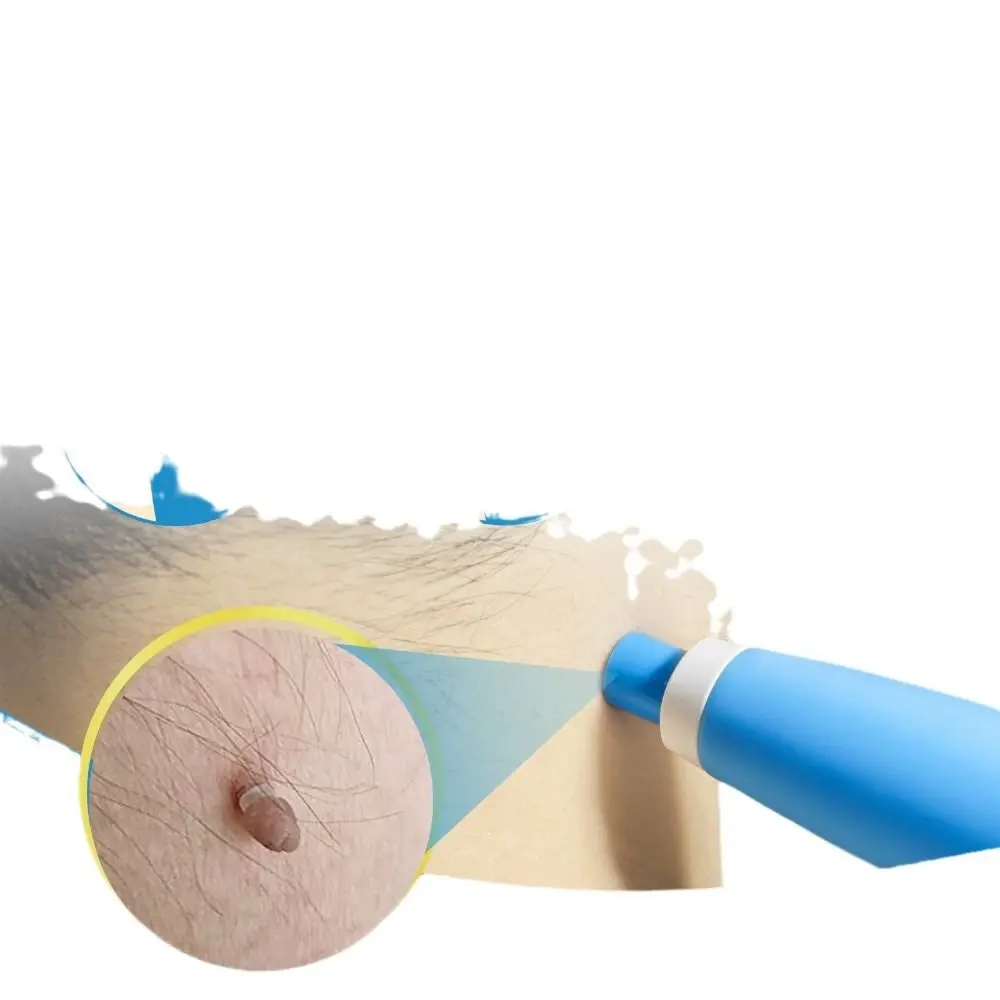 

2 in 1 Auto Micro Skin Tag Remover Device Cleaning Multifunction Mole Stain Wart Corn Remover Tool Health Universal