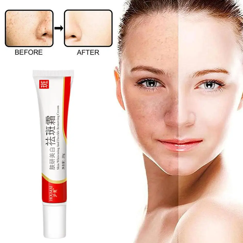 20g Whitening Freckle Cream Remove Dark Spots Anti Creams Face Care Pigmentation Brighten Skin Niacinamide Freckle Fade Mel Y2c9