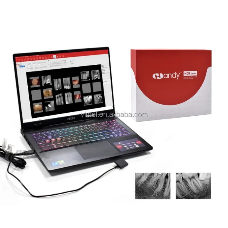 

Original HDR 360 Digital Dental X-Ray Imaging System RVG Portable Wireless USB Sensor Software Stability