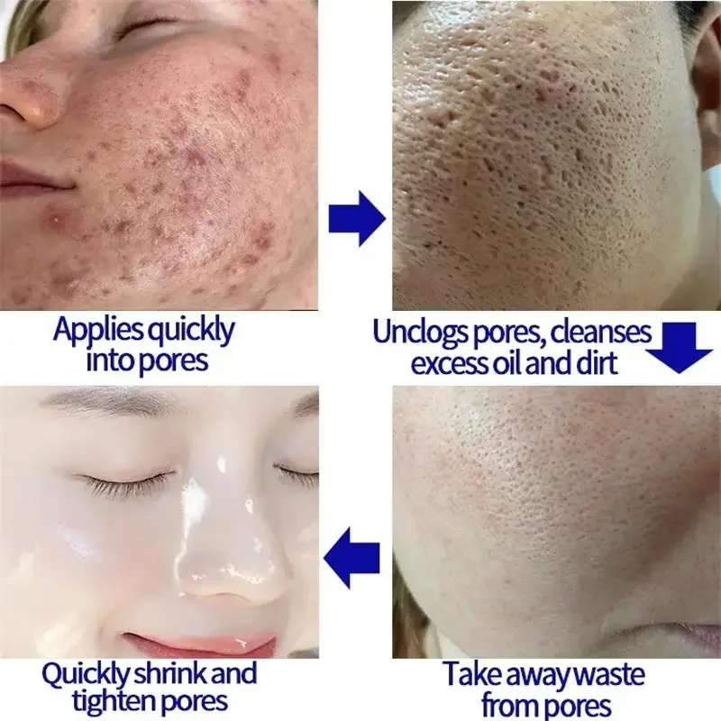 Pore Shrinking Facial Serum Remove Large Pores Tightening Repair Pore Minimizing Blackhead Removal Oil Control Smooth Skin Care