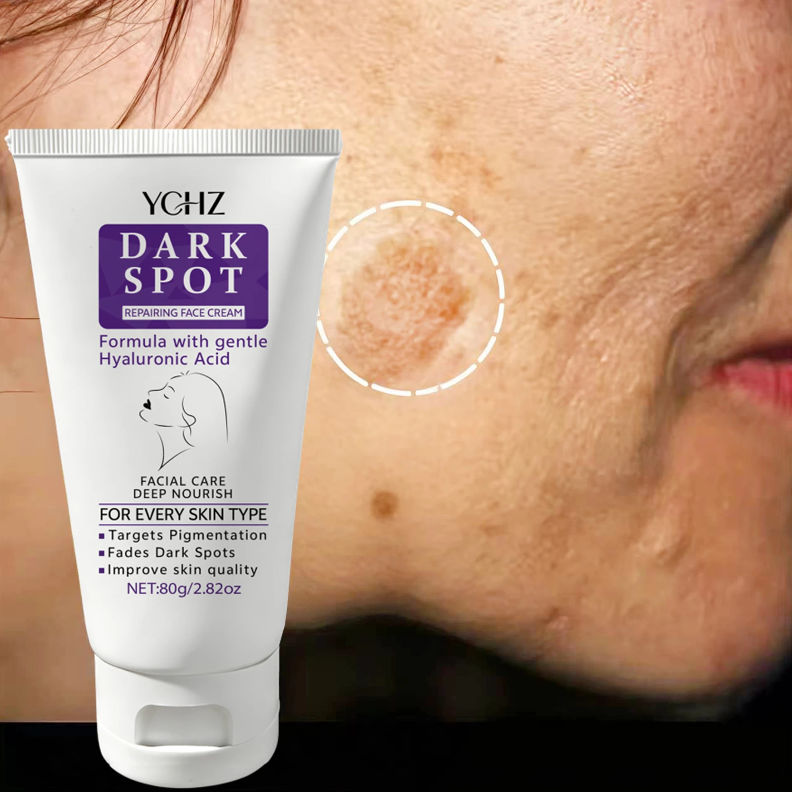 Dark Spot Face Cream for Daily Hydration, Nourishes the Skin, Improves Uneven Skin Tone and Dull Appearance, Has a Refreshing and Non-Greasy Texture, Suitable for Day and Night Use for All Skin Types