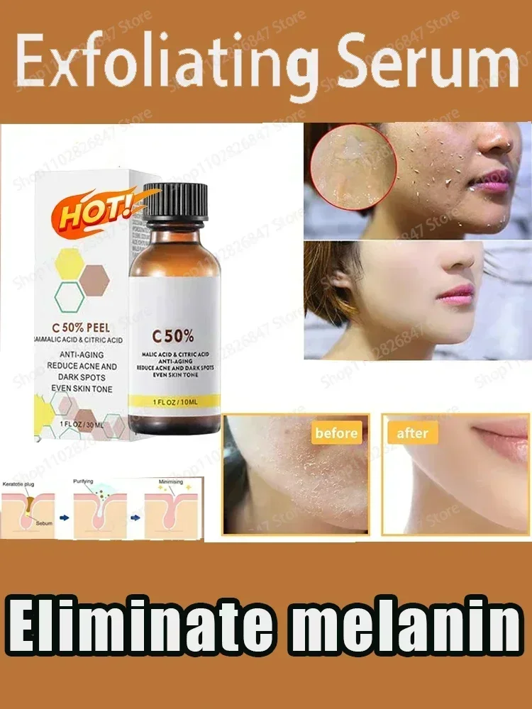 Minyak pengelupas, pemutih bintik kulit gelap menghilangkan mati mencerahkan Melanin Scrub pengelupas kulit pelembab perawatan kulit wajah Eksfoliasi