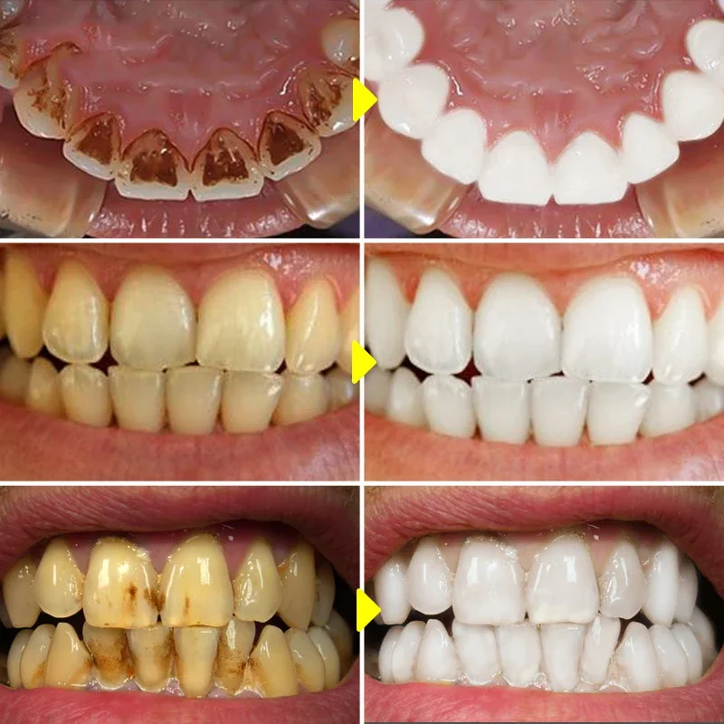  V34 Pro Purple Teeth Whitening Toothpaste Remove Plaque Stains Reduce Yellow Mousse Clean Oral Hygiene Dental Tools Fresh Brea