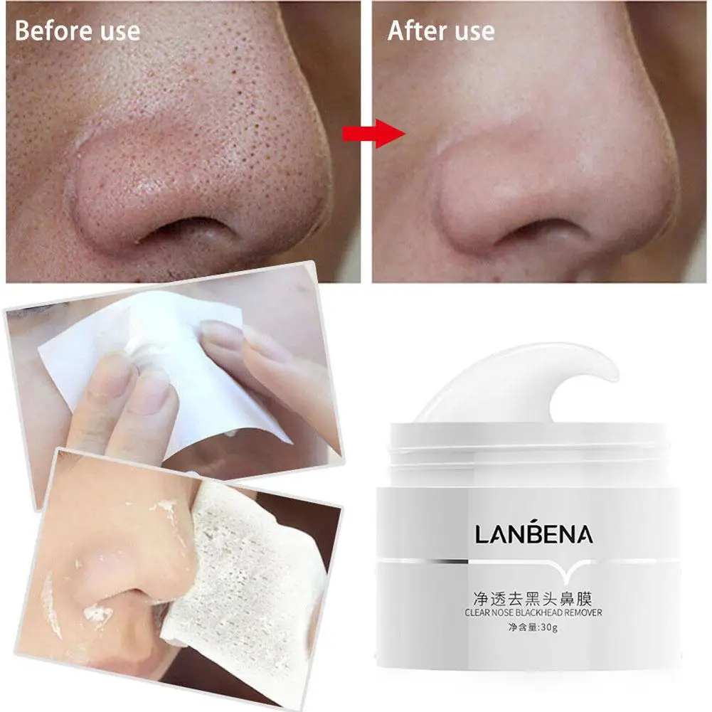 LANBENA-Kit de crema removedora de espinillas con tiras de papel para poros, limpieza de acné nasal, puntos negros, máscara de barro, máscara de cuidado de la piel