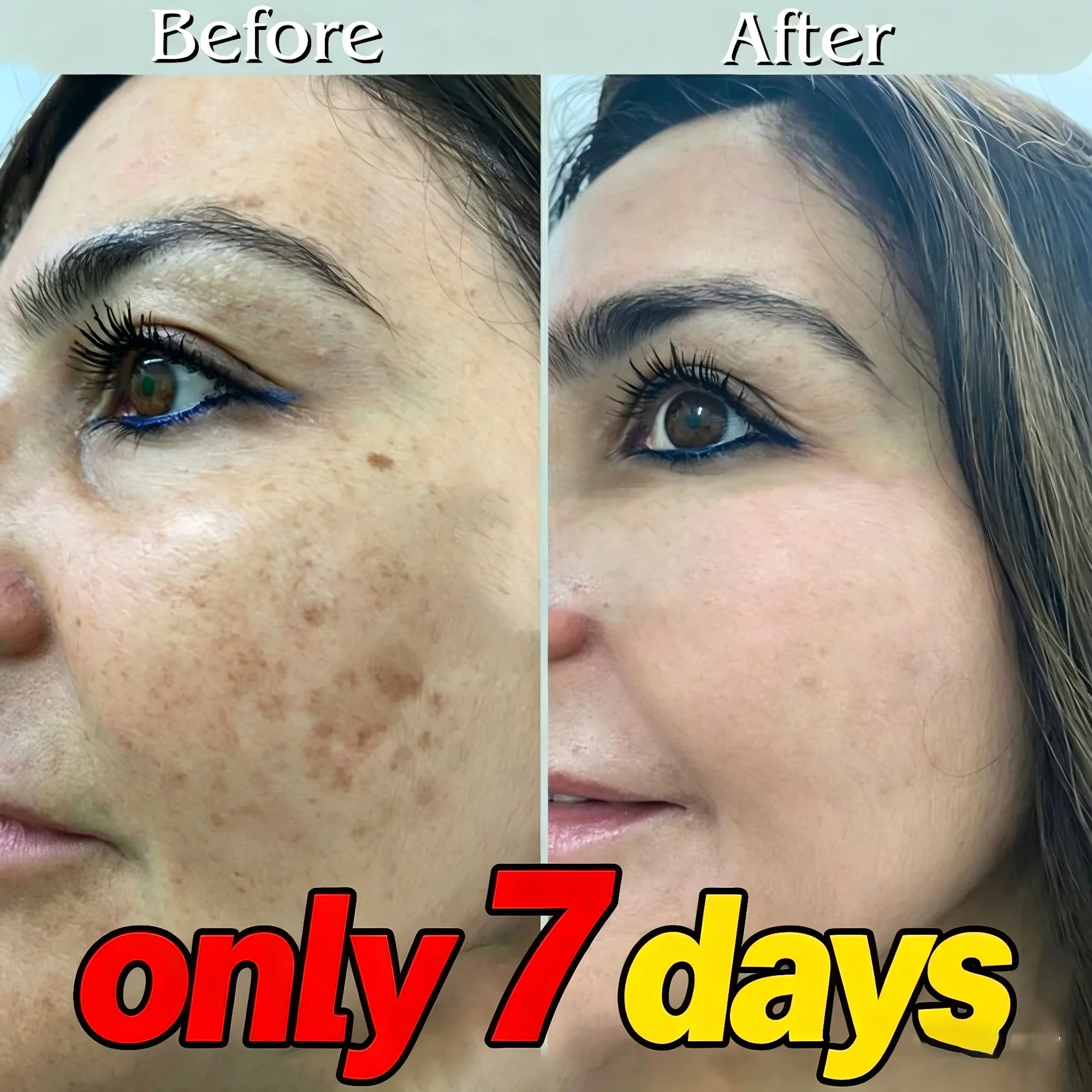 

Highly rated, free shipping, freckle-removing cream. A gentle facial skincare product that helps improve skin smoothness.