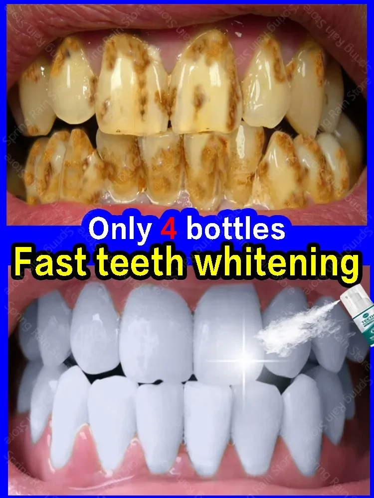 Quick And Deep Cleaning Of Teeth To Coffee Stains