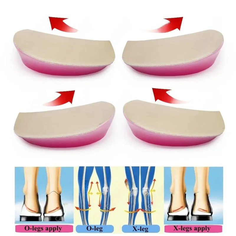 coussinets-de-talon-en-silicone-pour-la-correction-des-jambes-en-o-et-en-x-accessoires-de-mode-sans-marque-hiver-2024-semelles-interieures-confortables-pour-chaussures