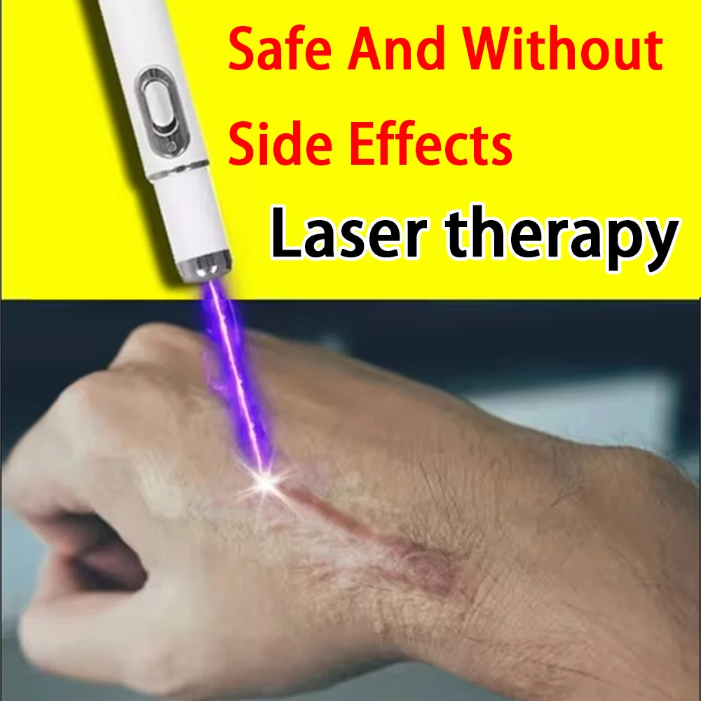 new Laser therapy Keloid scar