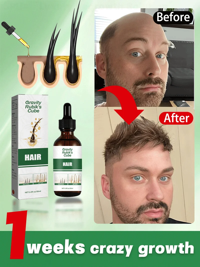 

Solve some of your hair problems