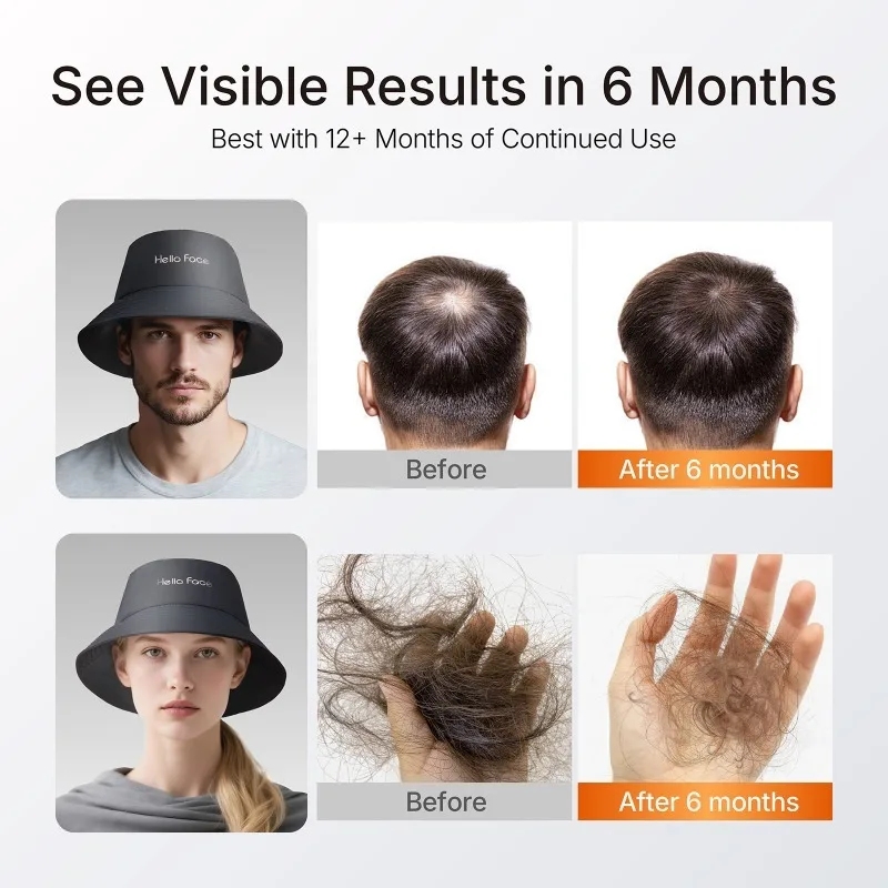 Berretto per terapia con luce rossa a LED Maschera per capelli a matrice di fotoni Ricaricabile Rilassamento Attrezzatura per la cura della testa Fisioterapia Dispositivi di bellezza per uso domestico