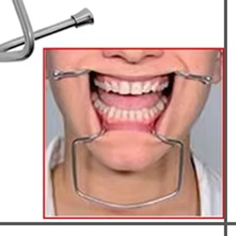 

High-Quality Autoclavable Dental Orthodontic Lip Cheek Retractor Stainless Steel Mouth Opener Dental Tools