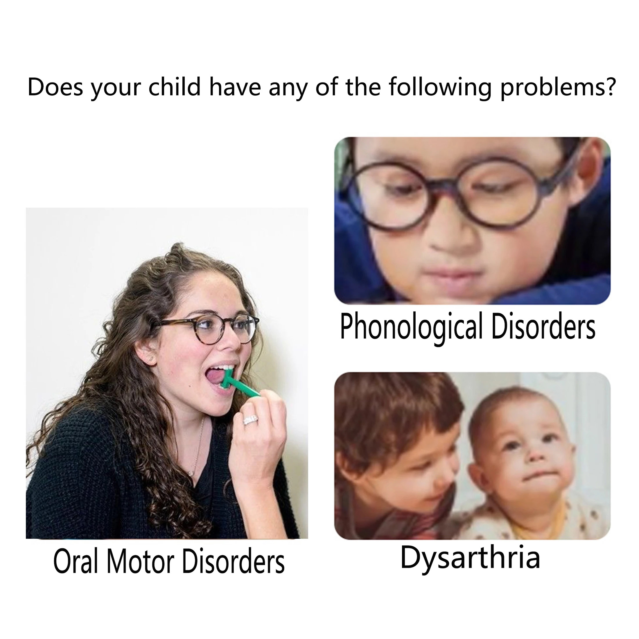 

Oral Muscle Training Tool Speech Therapy Tools Adults Kids Tongue Tip Lateralization Elevation Tools Autism Tongue Tip Exercise