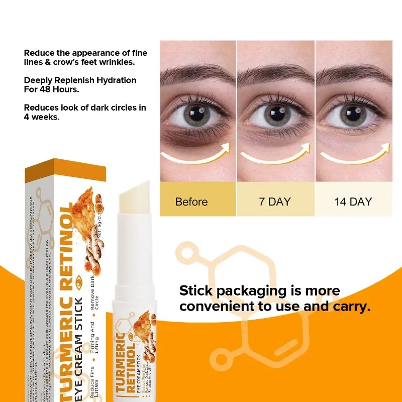 Beleza coreana Instant Eye Care Creme, Anti partículas gordas, círculos escuros, inchaço, desvanecer-se linhas finas, elevador, iluminar, saco, remover