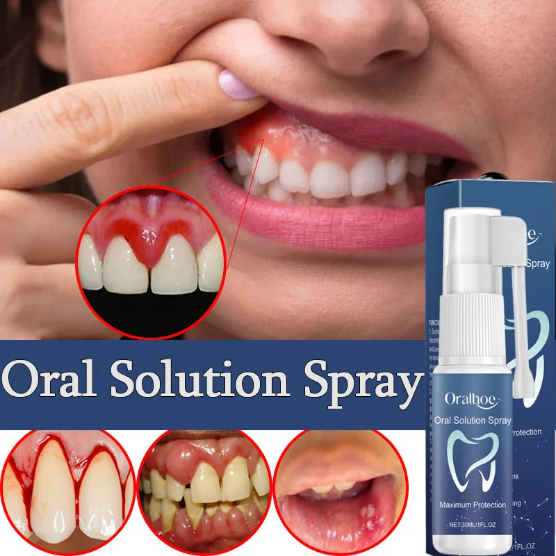 

Сыворотка-спрей для восстановления десен эффективно снимает аллергию зубов, зубной кариес, зубная паста для чистки зубов, снимает повреждение зубов сыворотку