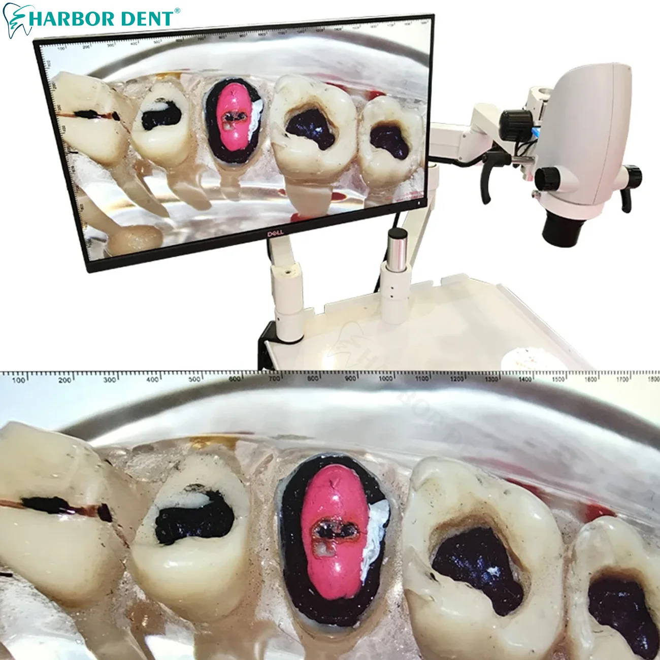 Microscópio de canal radicular dental com câmera 5x-33x zoom contínuo equipamento de odontologia personalização da unidade de cadeira