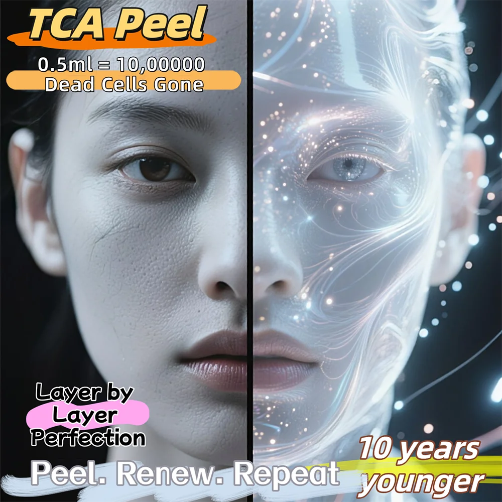 TCA Peel pads 5% 10% 15% 20% 30% 35% 2fl.oz about 50 pads Chemical Peel 60ml for Stubborn Acne Scars & Large Pores At Home