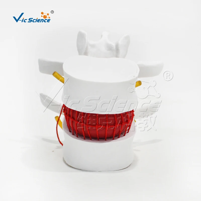 Medical Science Modelo bloqueio lombar, Espinha Humana