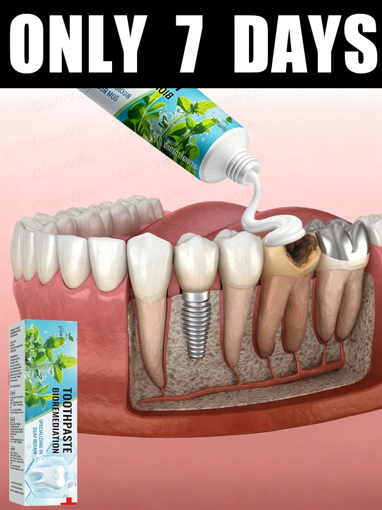 

Eᴀsɪʟʏ ʀᴇɢᴇɴᴇʀᴀᴛᴇ ɢᴜᴍs ᴀɴᴅ ᴄᴏᴠᴇʀ ᴛᴇᴇᴛʜ ɪɴ 7 ᴅᴀʏs2025