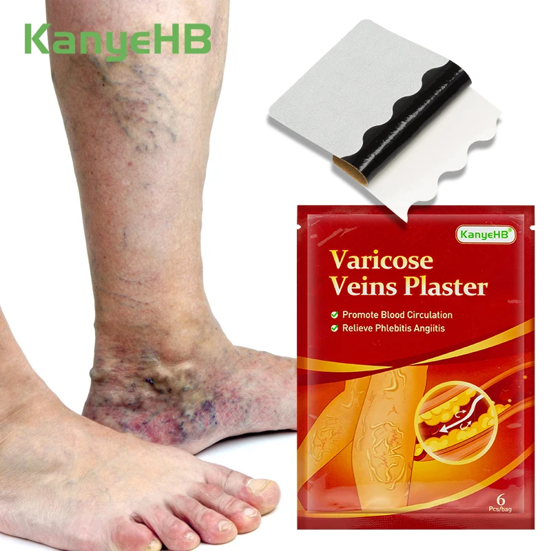 

6Pcs=1Bag Varicose Veins Treatment Patch Vasculitis Phlebitis Veins Pain Swell Varicosity Angiitis Herbal Medical Plaster W006