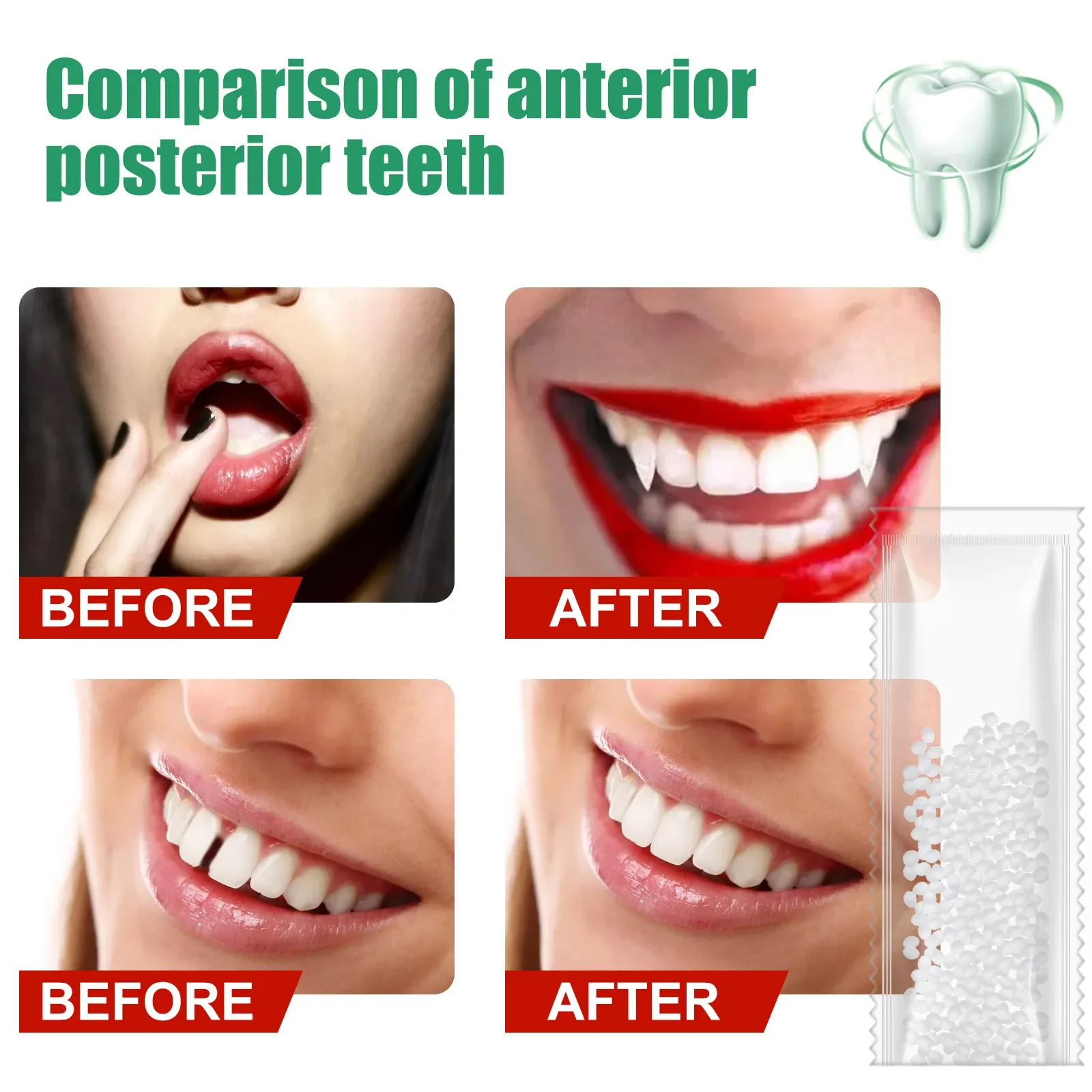 Dentes Temporários Reparação Cola, Dentes Lacunas De Enchimento, cola Sólida, Resina, Falseteeth, Segurança, Suprimentos Dental, Shapeable