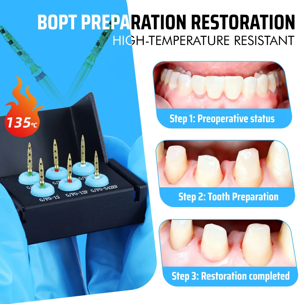 

3pcs Dental Preparation Vertical Diamond Bur Dental Preparation Restoration Kit Full Crown Restoration Dental Tools FG7906