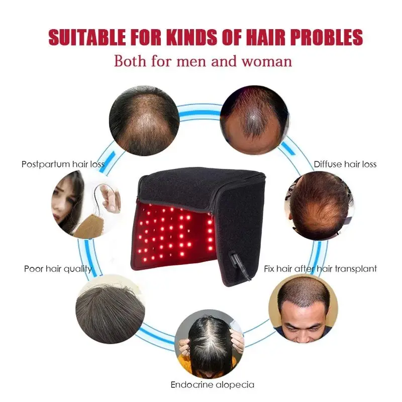 

For Hair Regrowth Laser Red Light Therapy Hair Growth Cap All Natural Therapy Results Quickly Hair Loss Treatments Hat