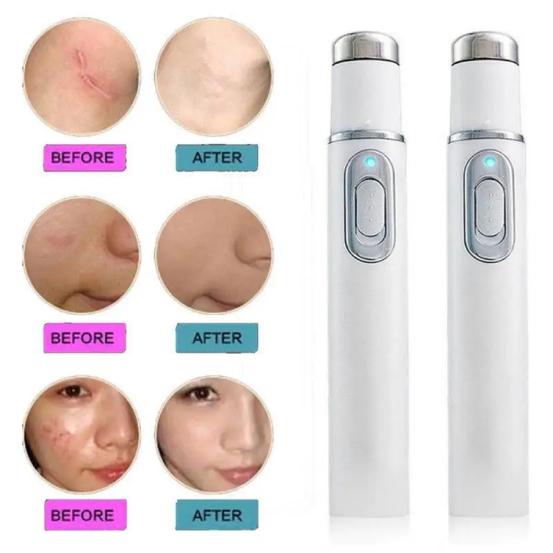 Blue Light Eye Massager Voltage Dc1.5v Soothe Tired Eyes Improve Blood Circulation Portable And Convenient Reduce Dark Circles