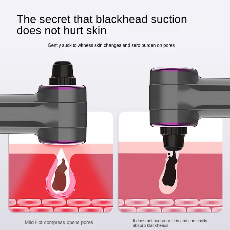 毛穴を掃除するための電気吸引装置,にきびを取り除く装置,熱圧縮,毛穴を開く,送料無料