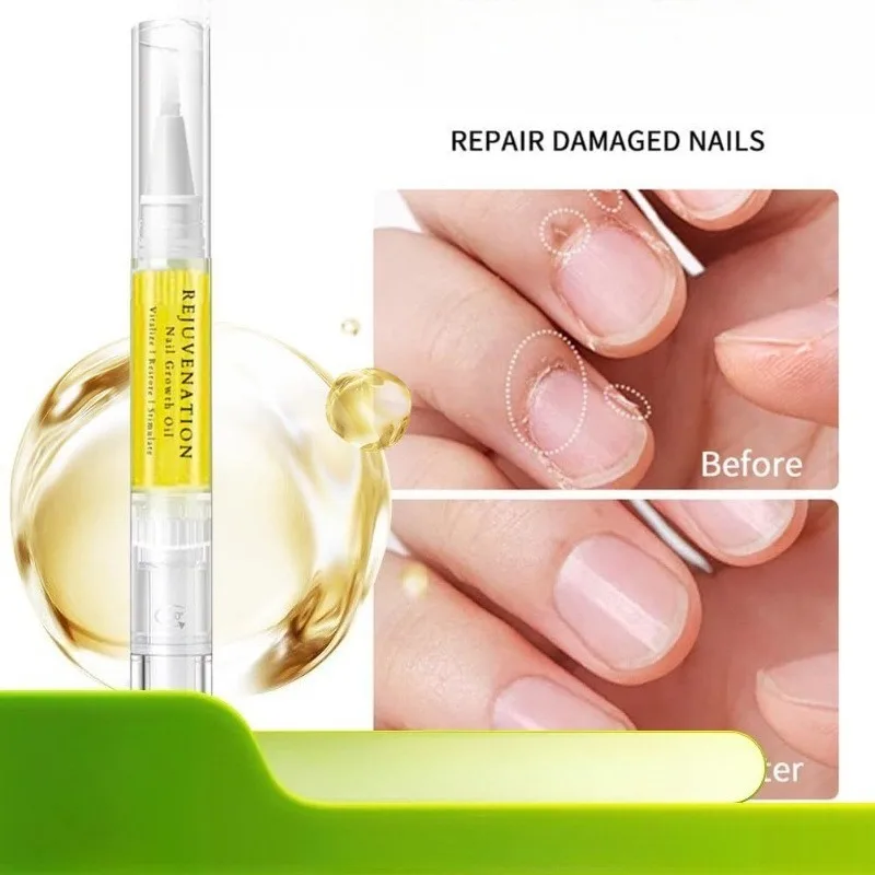 1PC Penna per olio per cuticole per unghie Olio per cuticole Cura delle unghie Nutrizione Penna per olio Riparazione Unghie danneggiate Idrata Rafforzare il prodotto luminoso per unghie