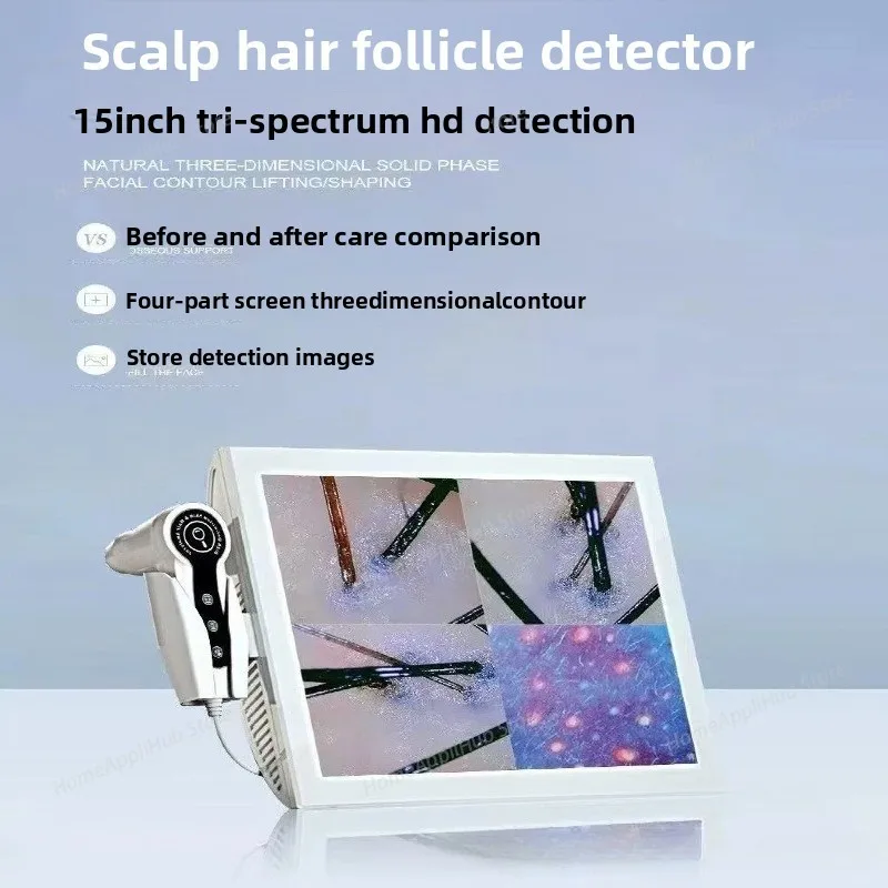 15 Inch HD Display 50/200X Professional Hair Follicle Detector Scalp Diagnostic Machine Skin Analyzer Oil Moisture Skin Tester