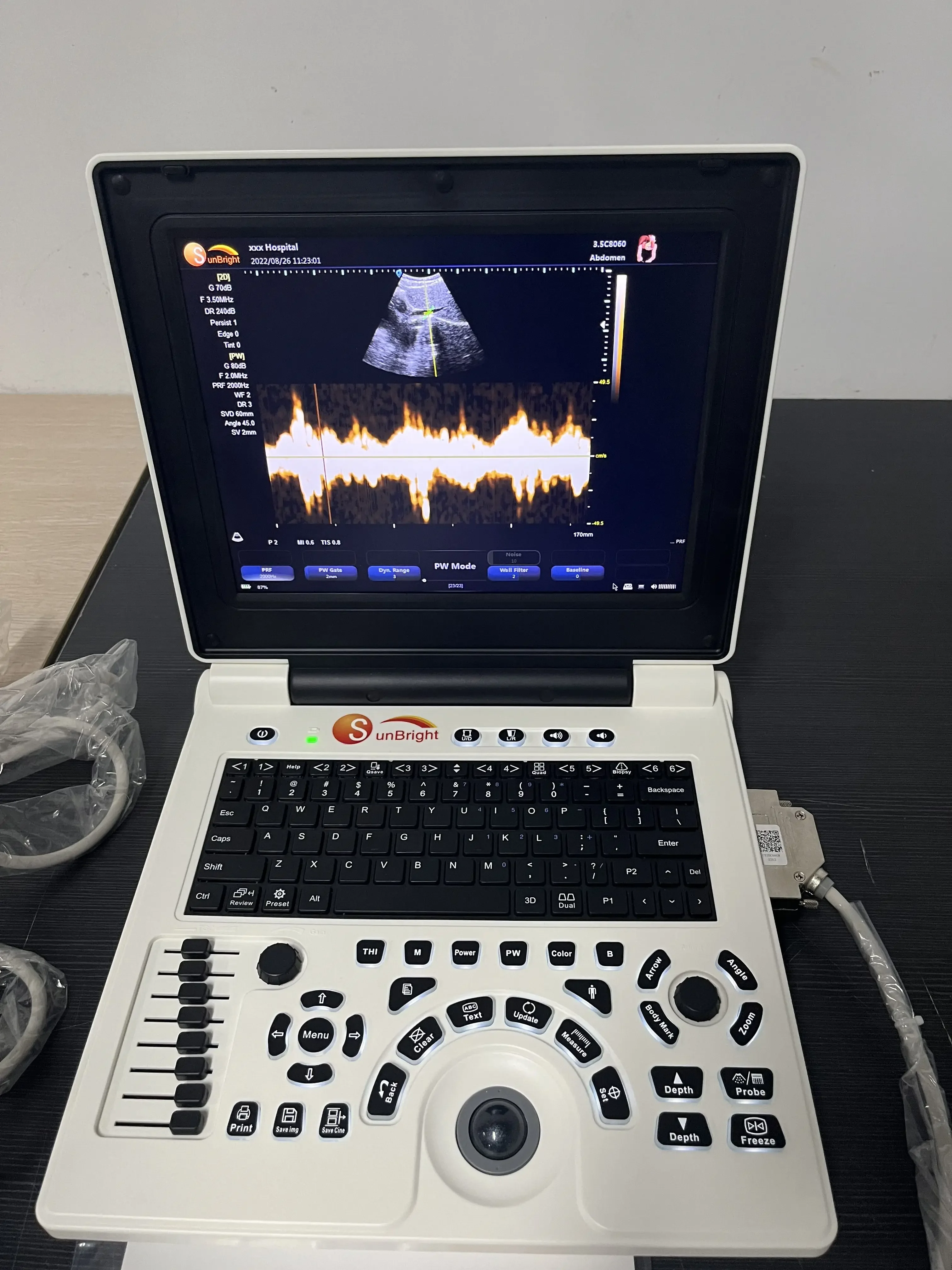 Diagnostic laptop color doppler ultrasound 12 inch LED display medical portable echocardiography machine