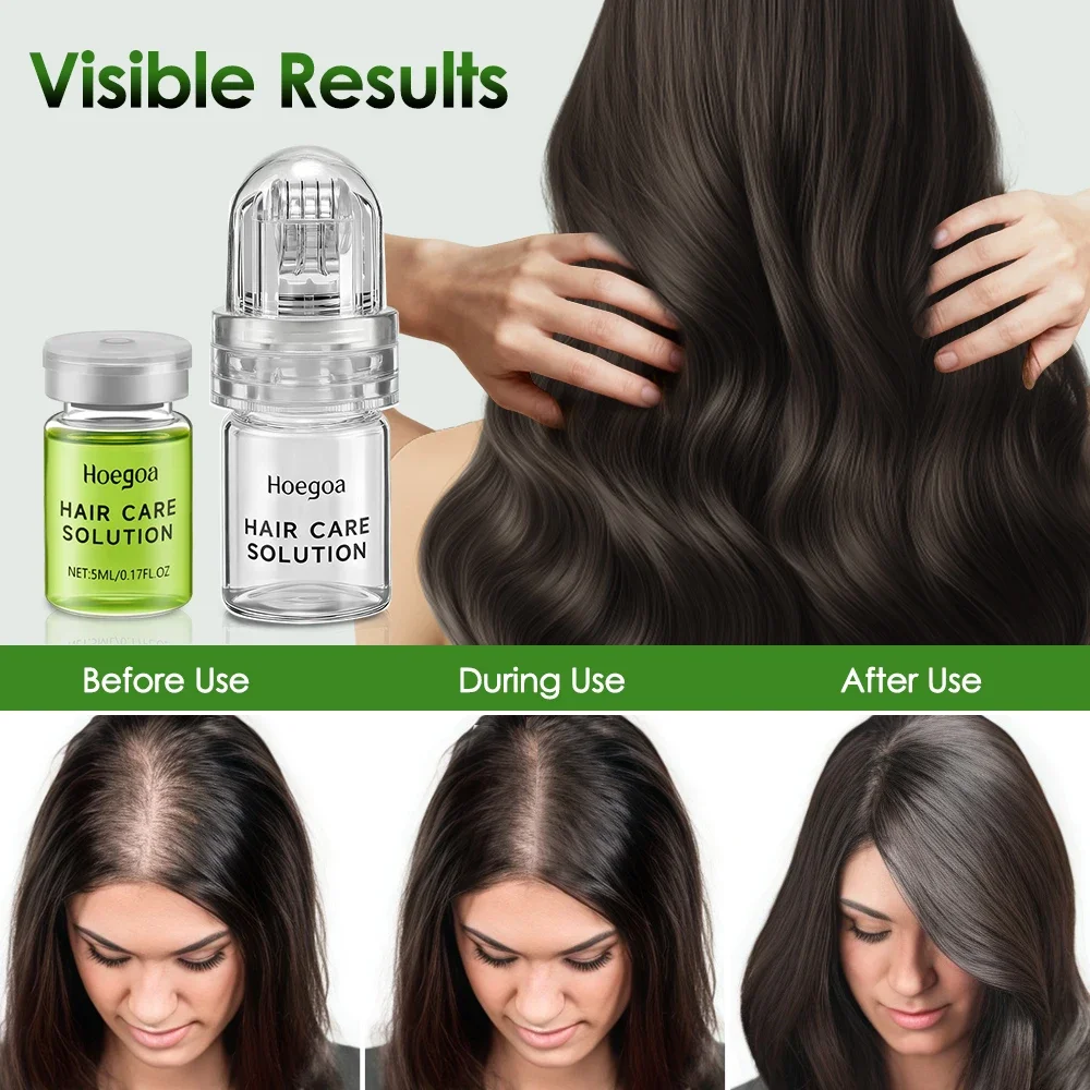 Hair Essential Care Serum Strengthen Roots Reducing Loss Prevent Baldness Nourish Scalp Hair Care Anti-Hair Loss Conditioner image 4