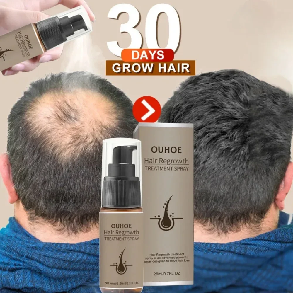 Powerful Hair Growth Serum Spray Ginger Anti Hair Loss Treatment Products Repair Nourish  Roots Fast Regrowth Hair Men Women