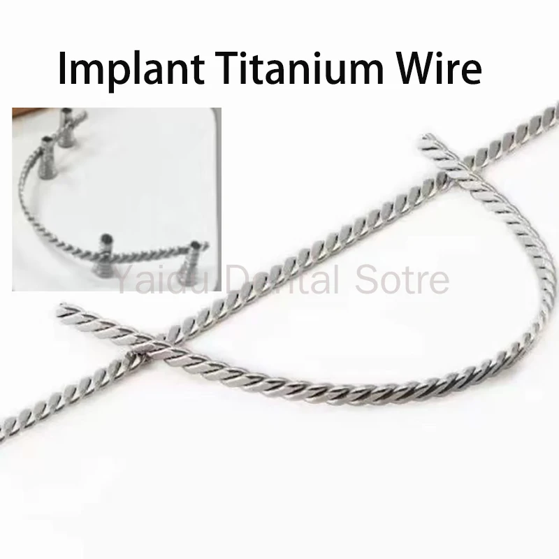 30PCS Special Fixed Steel Wire Dental Implant Link Immediate Load-Bearing Cold Weldable And Bondable for Temporary Dentures