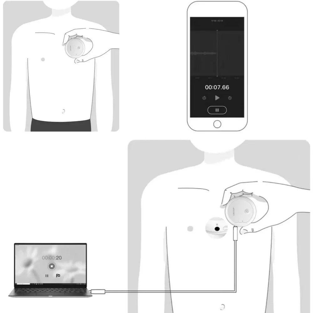 Wireless Digital Stethoscope Bluetooth Amplified Stethoscope For  Heart Rhythms Lung Sounds Phones And PC Data Record