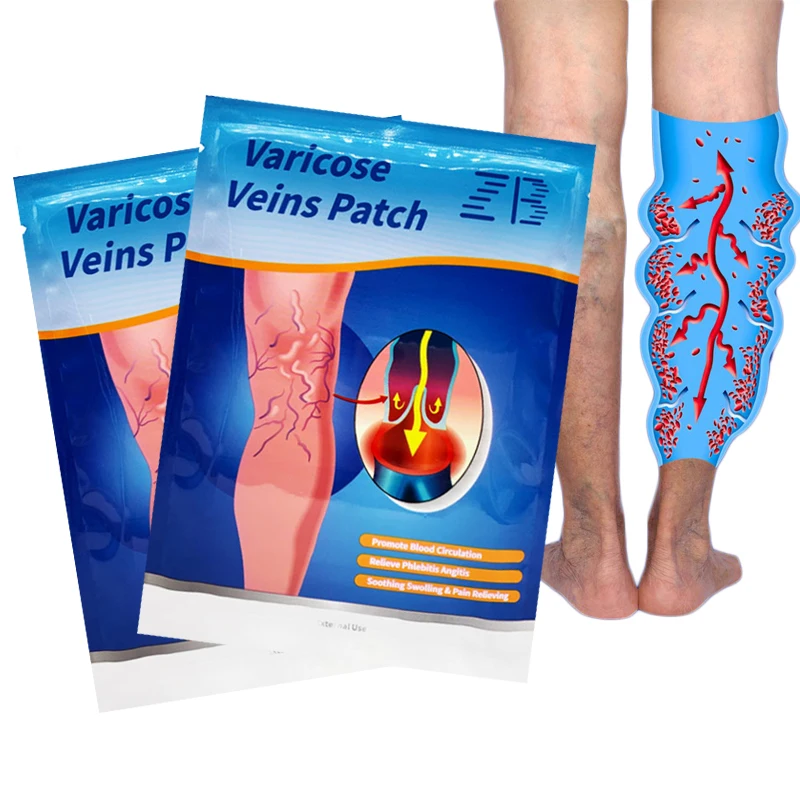 6pcs Varicose Veins Patch Vasculitis Phlebitis Spider Cream Varicosity Angiitis Ointmnet Removal Herbal Medical Plaster