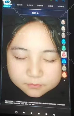 15.6 بوصة جديد ثلاثية الأبعاد آلة تحليل بشرة الوجه محلل الجلد آلة الوجه 8 الطيف الخفيف تحليل الجلد الماسح الضوئي #1