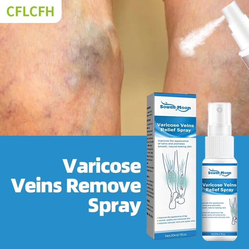 

Varicose Veins Treatment Spray Spider Leg Vasculitis Phlebitis Varicosity Relief Angiitis Legs Dilated Foot Care Herbal Medicine