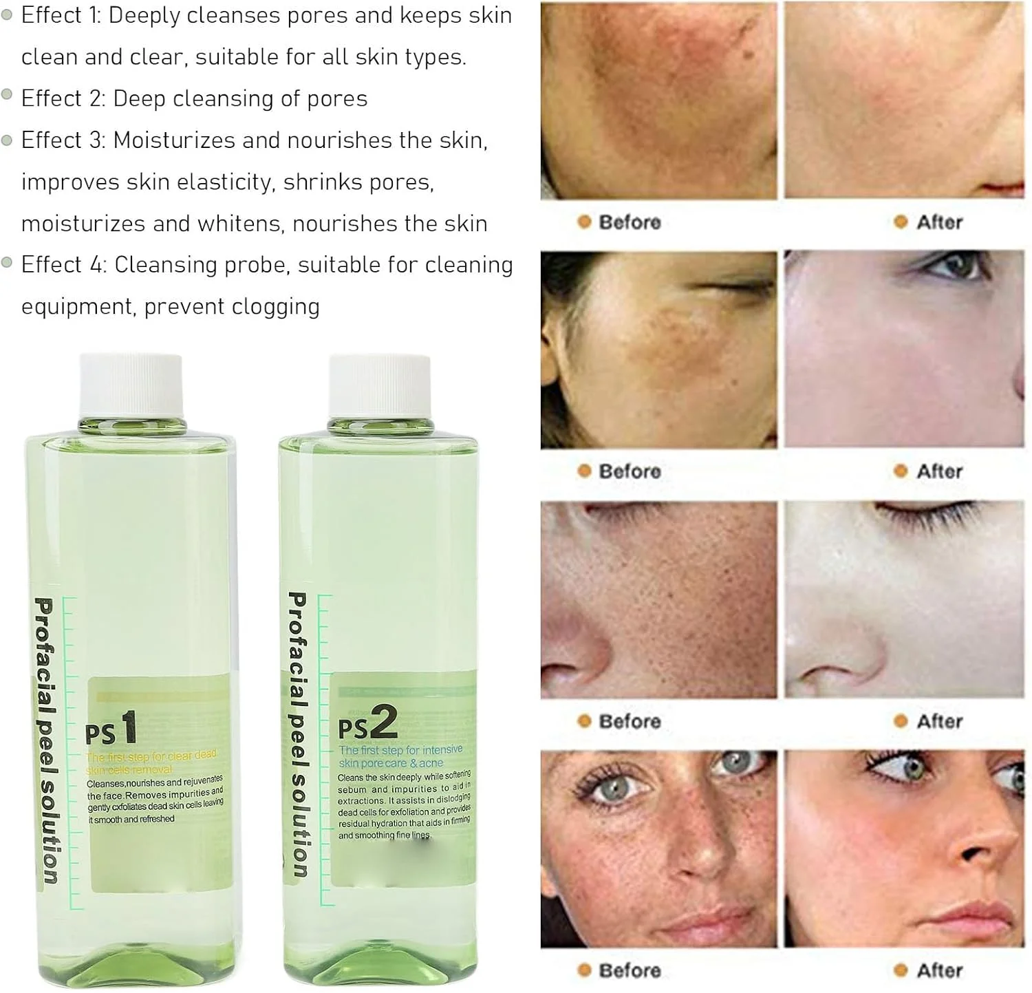 Professional Hydra Dermabrasion Solution for Face - Gentle Cleansing Serum with Hydrating Formula for Skin Refreshment