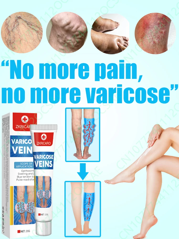 

Using this product can help you say goodbye to leg pain, 99% repurchase rate, the best-selling product