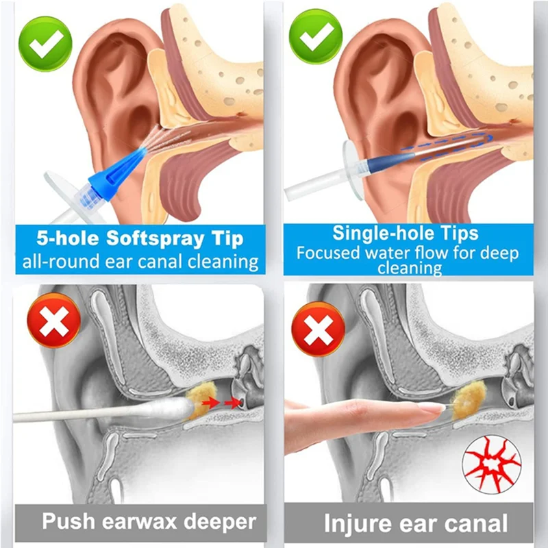 Earwax Removal Kit, Manual Ear Irrigation System, Safe And Effective Ear Cleaner For Removing Built-Up Wax