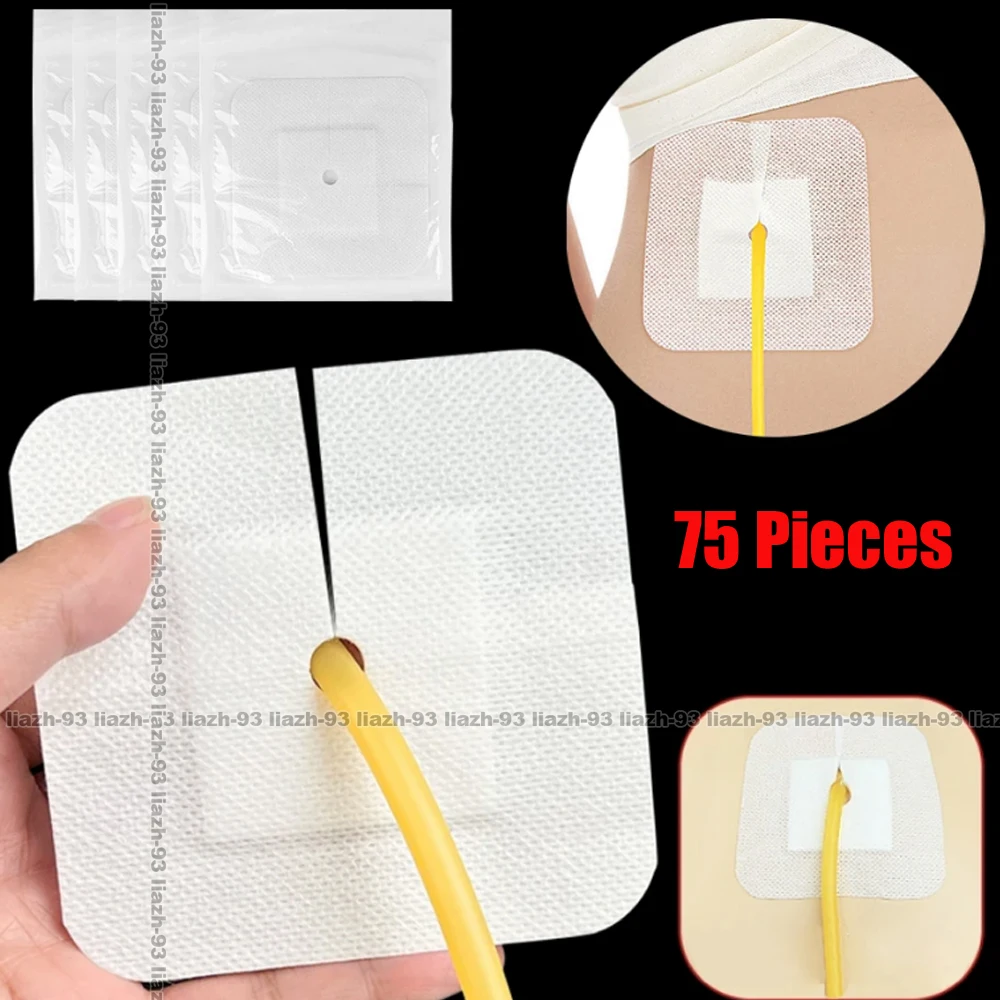 

75 штук: Стерильные нетканые пластыри с отверстием для фиксации мочевого катетера при пункции почек, для дренажных трубок и перевязки ран