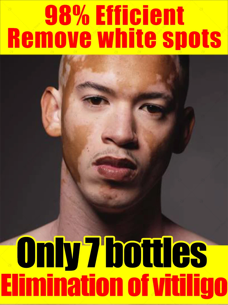 

Blue laser care for vitiligo