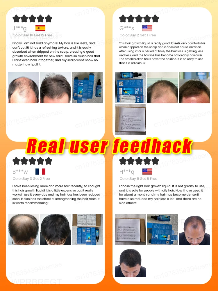 Hᴇʀʙᴀʟ ʜᴀɪʀ ɢʀᴏᴡᴛʜ ᴏɪʟ ᴘʀᴇᴠᴇɴᴛs ʜᴀɪʀ ʟᴏss ᴀɴᴅ ʜᴇʟᴘs ᴡɪᴛʜ ʀᴇᴄᴇᴅɪɴɢ ʜᴀɪʀʟɪ