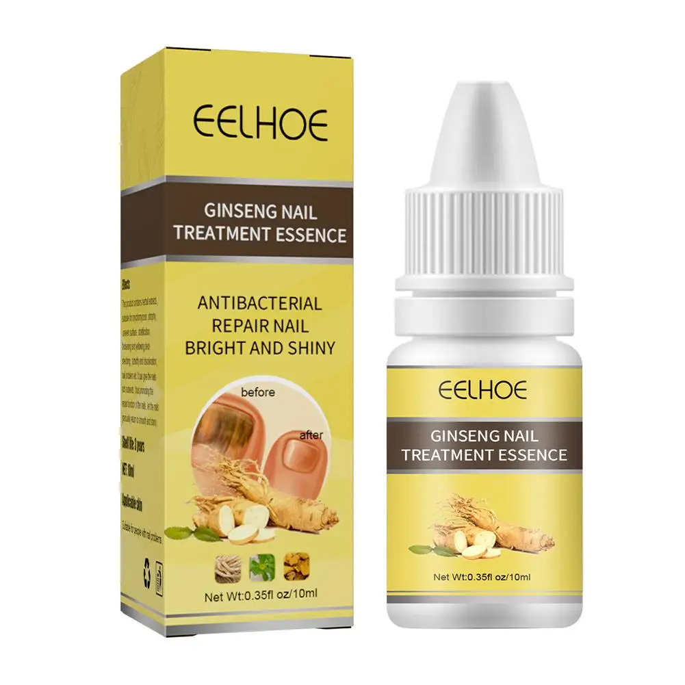 10Ml Nagel Schimmel Verwijdering Crème Onychomycosis Schimmel Nagel Schimmel Nagelinfectie Zorg Zalf Anti Behandeling Voeten Teen Paronie Q4i9