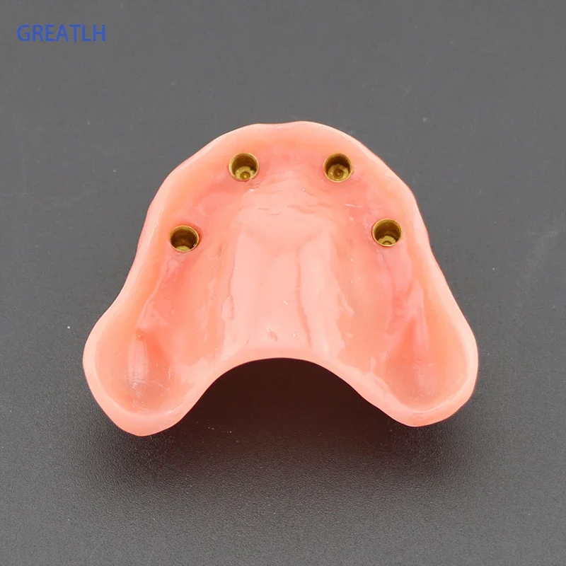 1pcs /pack Dental Upper Overdenture Superior 4 Implants Demo Model 6001 02 Teeth Model