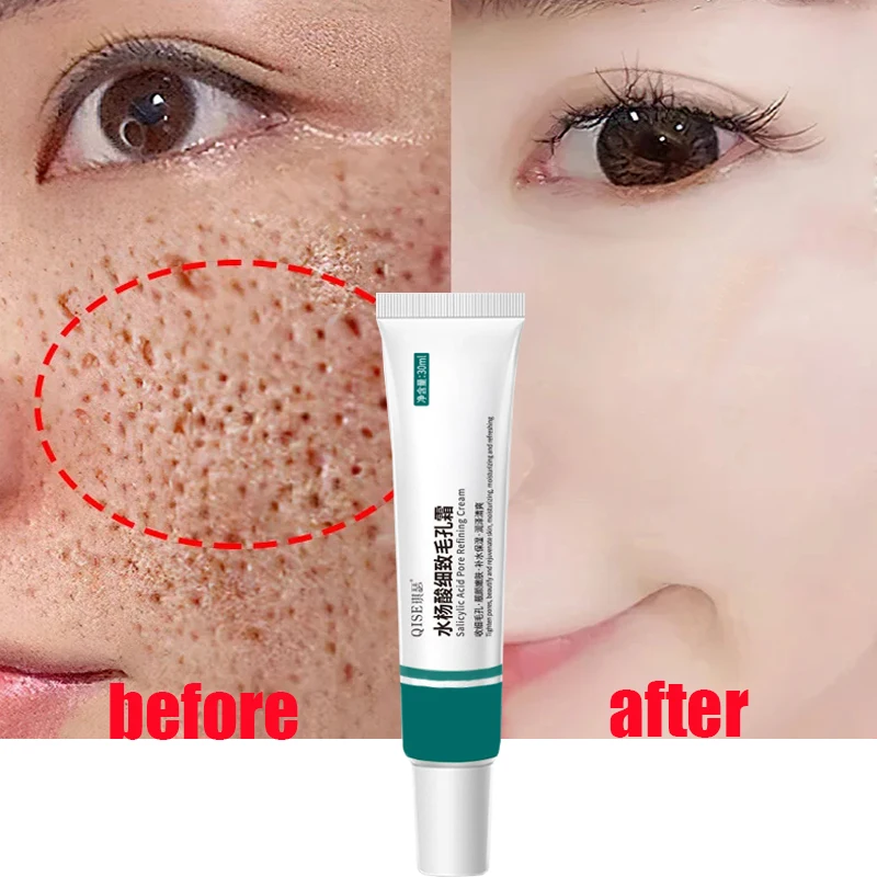 

Salicylic Acid Pore Shrinking Cream Large Pores Tightening Repairing Serum Moisturizing Oil Control Skin Care Korean Cosmetic