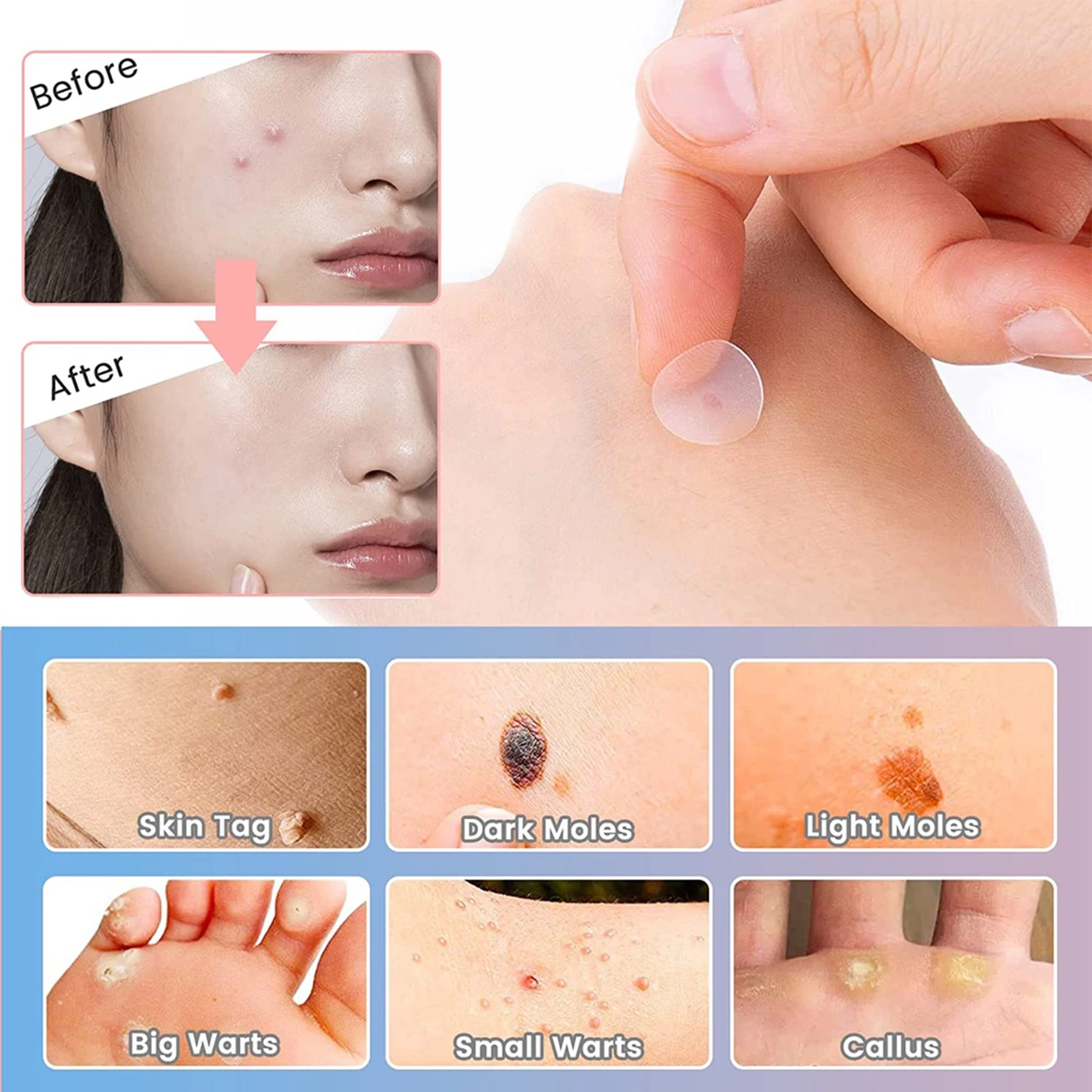 【Hot sales】72Pcs Invisible Removal Pimple Anti-Acne Hydrocolloid Patches Spots Marks Concealer Waterproof Repair Sticker image 4