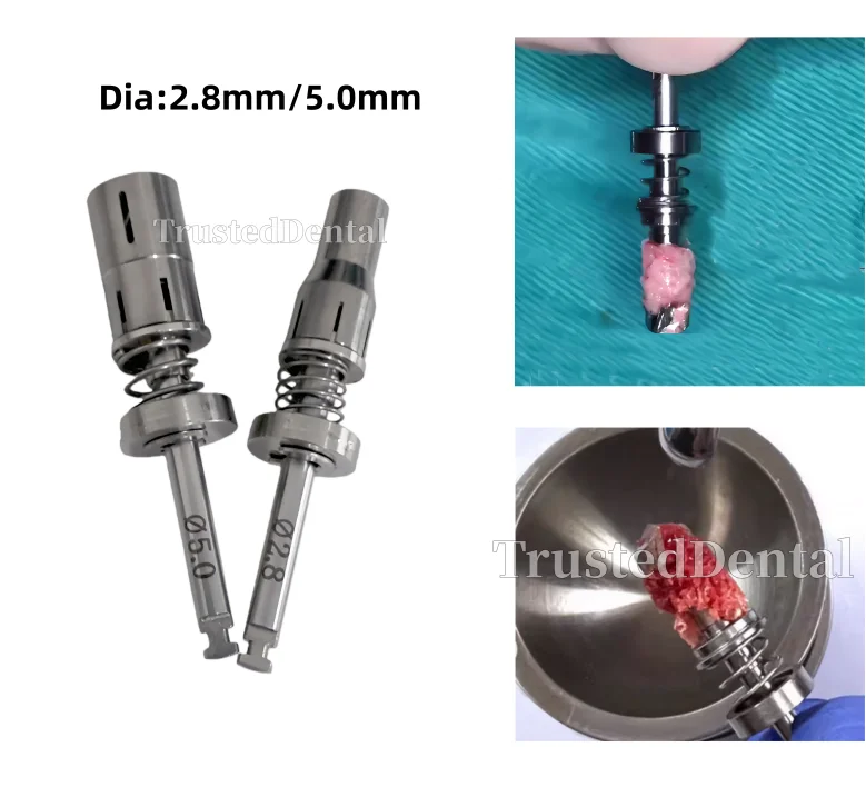 

Dental Trephine Burs Implant Spring Bone Harvesting Drill Self-grinding Bone Powder Collection Drill GBR