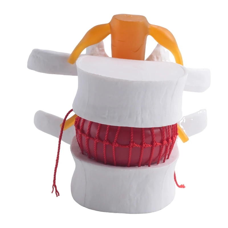 

Human Anatomy Skeleton Spine Lumbar Disc Herniation Teaching Model Brain Skull Traumatic School Supplies Instrume